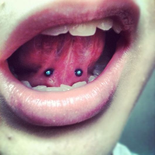 Tongue Piercing: Types, Care and How to Take Care of Inflammation!