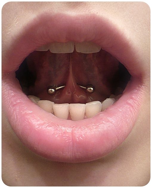 Tongue Piercing: Types, Care and How to Take Care of Inflammation!