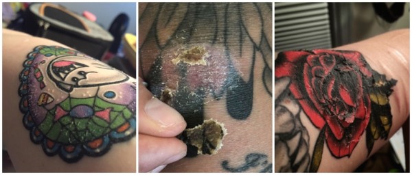 Peeling Tattoo – What to do? + Main precautions!