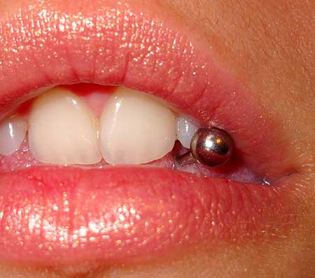 Gum Piercing: Does it hurt? Risks, precautions and tips!