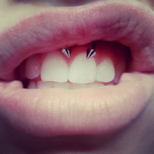 Gum Piercing: Does it hurt? Risks, precautions and tips!