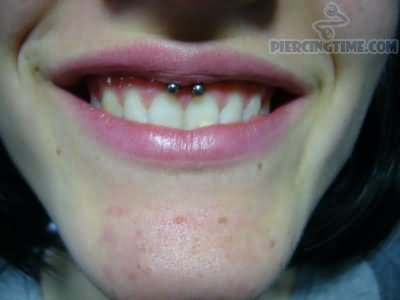 Gum Piercing: Does it hurt? Risks, precautions and tips!