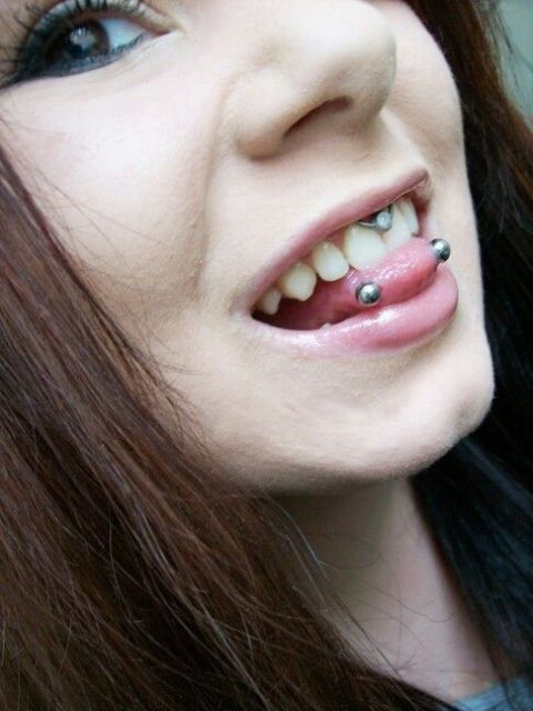 Gum Piercing: Does it hurt? Risks, precautions and tips!