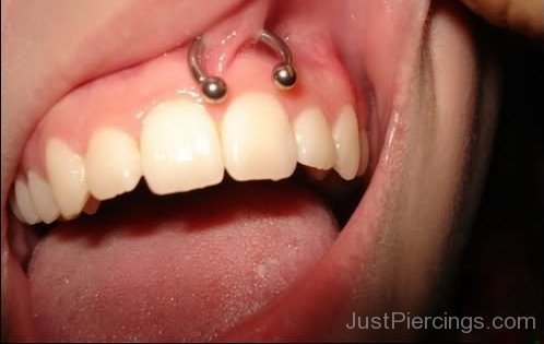 Gum Piercing: Does it hurt? Risks, precautions and tips!