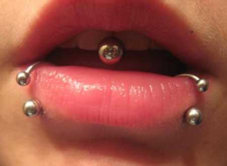 Gum Piercing: Does it hurt? Risks, precautions and tips!