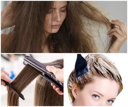 Cabello elástico: ¡5 soluciones para salvar los alambres engomados!