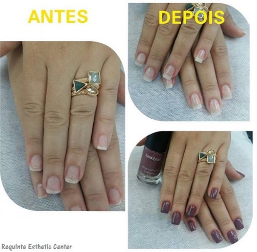 Ongles Acrigel – 57 Inspirations, Main Care & Step by Step !