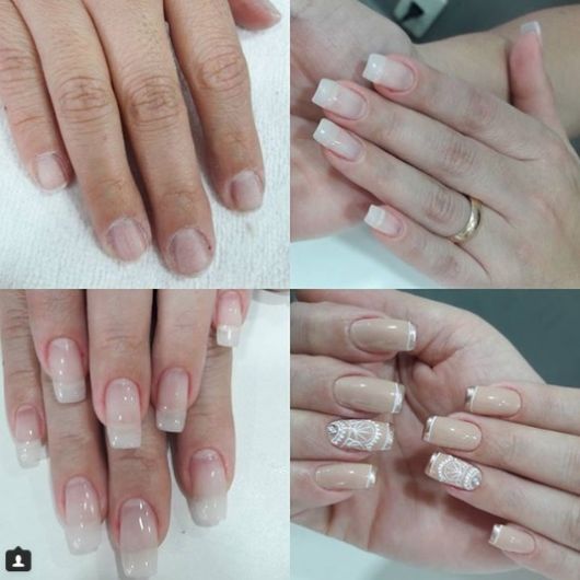 Acrigel Nails – 57 ispirazioni, cura principale e passo dopo passo!