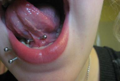 Tongue bridle piercing – what is it, how to put it on, tips and models