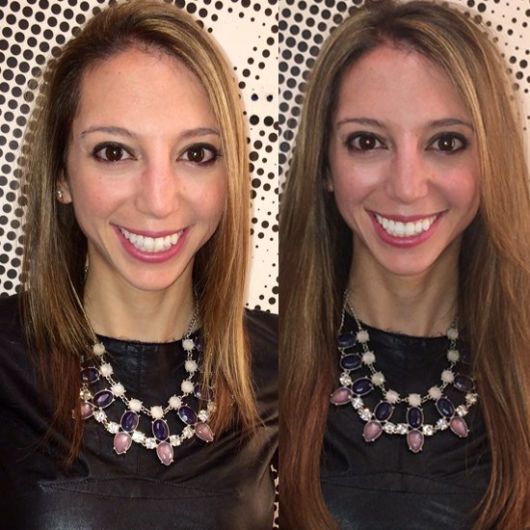 Cinta adhesiva Mega Hair: ¡cómo se coloca y fotos de antes y después!