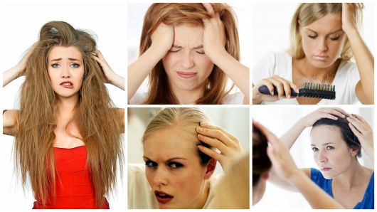 How to fight female hair loss: tips, causes and treatments!