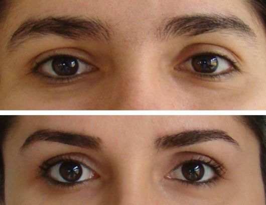 10 Eyebrow Photos Thread by Thread Before and After – Get inspired!