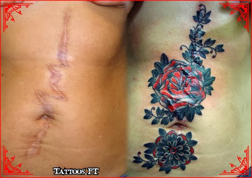 Tattoo to Cover Scar: Tips and more than 40 ideas!
