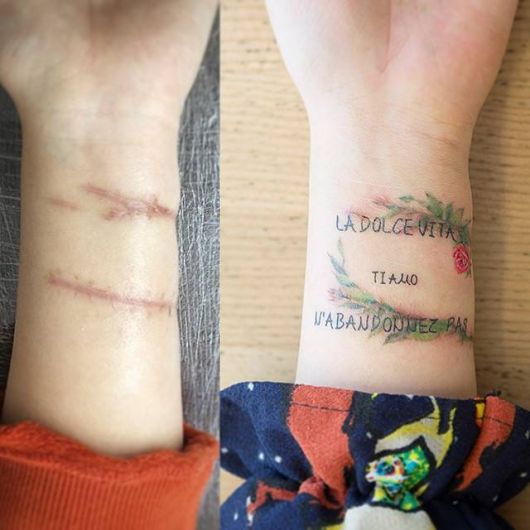 Tatouage pour couvrir une cicatrice : astuces et plus de 40 idées !