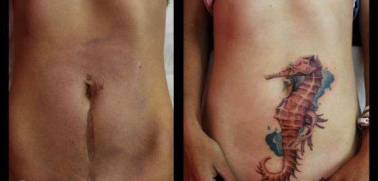 Tattoo to Cover Scar: Tips and more than 40 ideas!