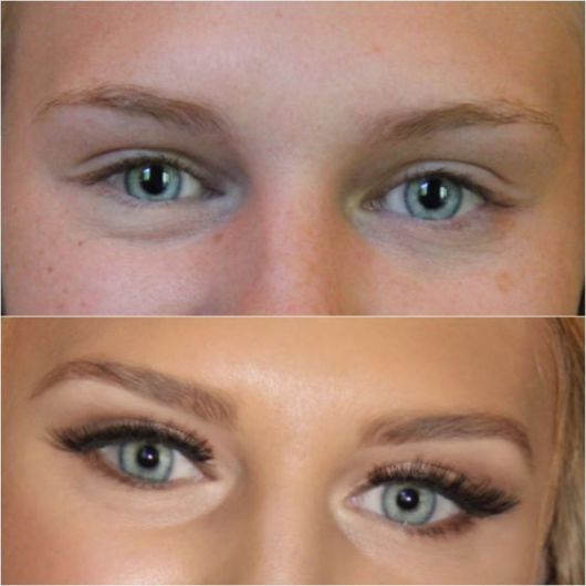 Aceite de ricino para cejas: ¡25 resultados antes y después!