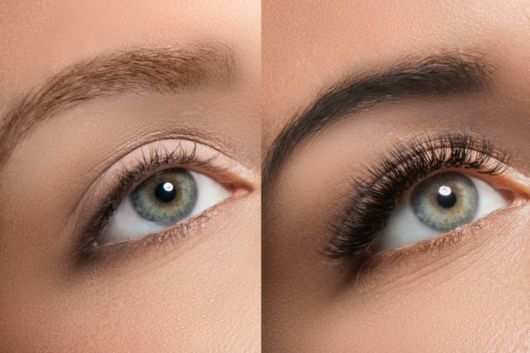 Huile de ricin pour sourcils – 25 résultats avant et après !