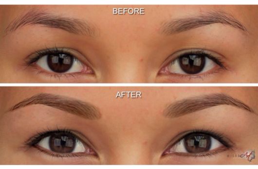 Huile de ricin pour sourcils – 25 résultats avant et après !