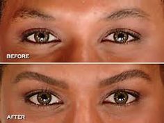 Aceite de ricino para cejas: ¡25 resultados antes y después!