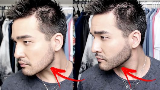 Barba calva: ¡5 soluciones eficientes, consejos y cómo disfrazarse!