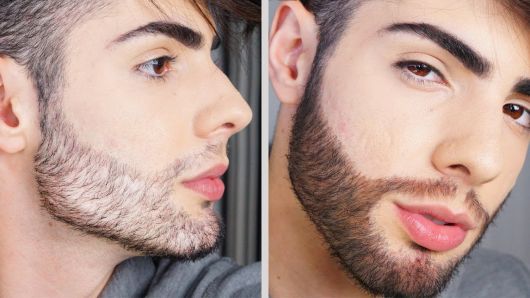 Barba calva: ¡5 soluciones eficientes, consejos y cómo disfrazarse!