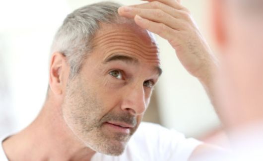 Top 4 Hair Loss Remedies – List of Best Products!