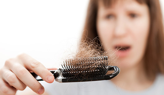 Los 4 mejores remedios para la caída del cabello – ¡Lista de los mejores productos!