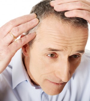 Male Pattern Baldness – Causes, Treatments & Surefire Tips!