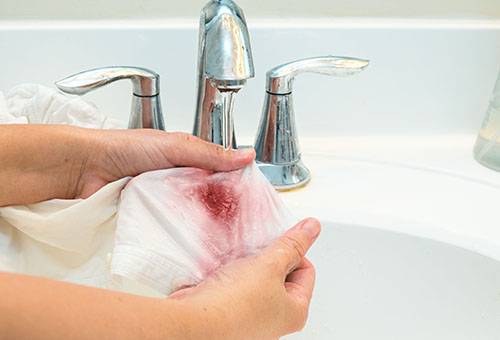 How to Remove Hair Dye Stains
